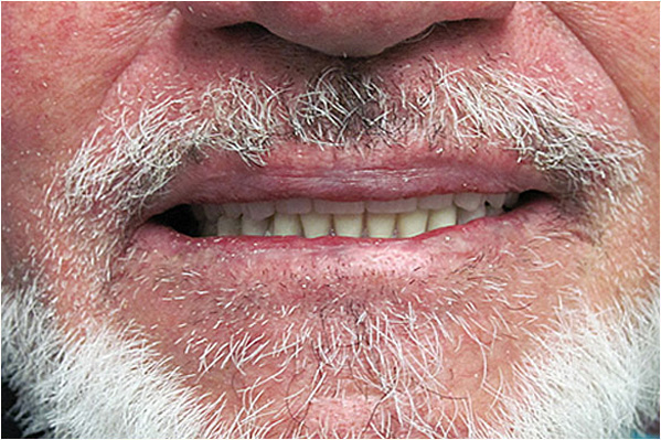 The image shows a man with a full beard and mustache, displaying a smile with his mouth open slightly.