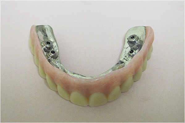 The image shows a single upper denture with multiple teeth, placed on a plain surface against a white background.