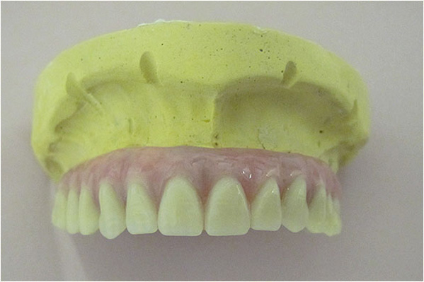 A yellow model of a human skull with an open mouth, displaying a set of white teeth.